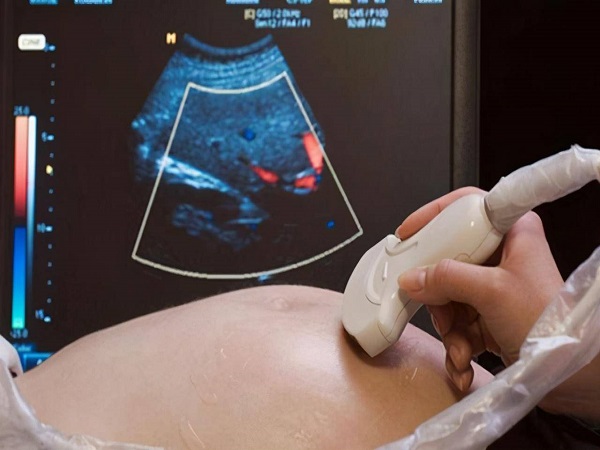 B超检查是孕期必备的检查