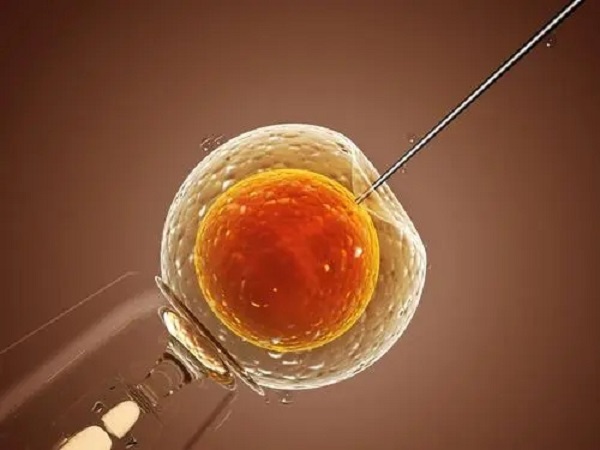 试管婴儿是目前最先进的辅助生殖技术