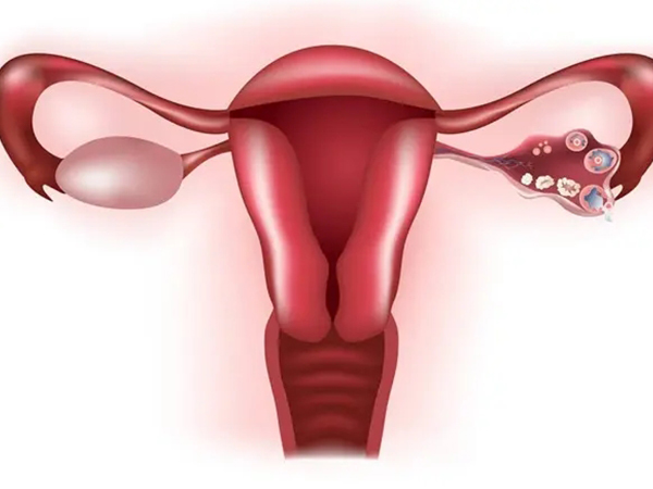 孕酮分泌少会影响卵巢功能