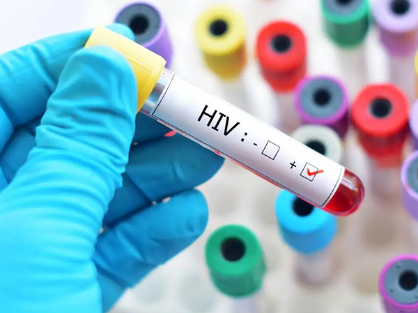 在泰国做hiv洗精术需满足一定要求