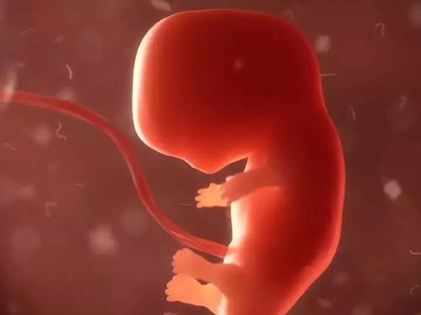 孕妇染色体异常会导致胎停