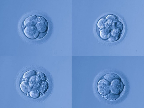 胚胎发育情况会影响移植的胚胎