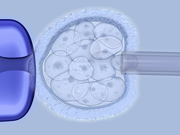 胚胎送检要半个月才会出结果