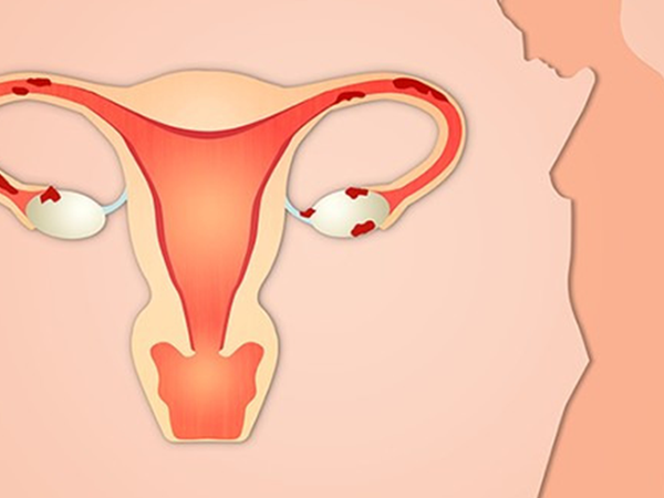 卵巢储备功能下降比较难调理