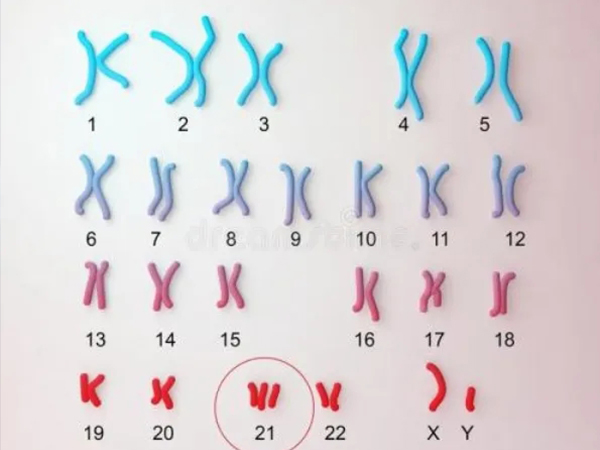 染色体异常不一定导致不孕不育