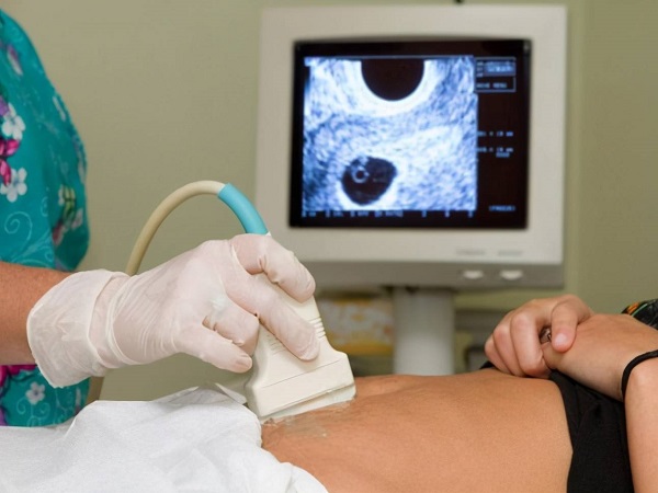 孕囊形状可以鉴定胎儿性别