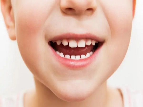 导致儿童玉璞蛀牙洞的原因很多