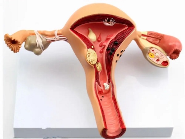 子宫内膜的厚度会影响女性受孕
