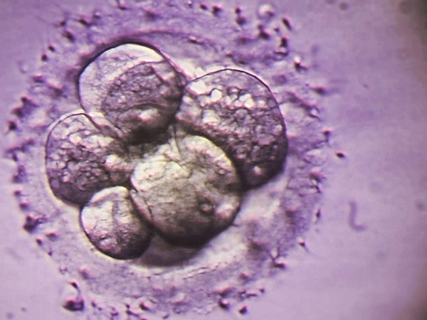 6期囊胚已经脱离透明带