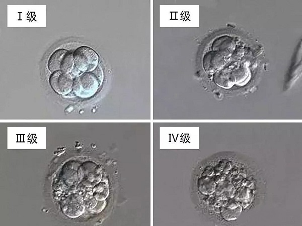 胚胎是有等级划分的