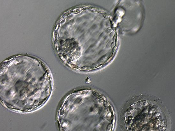 第三天融合胚胎不是特级胚胎