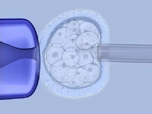 胚胎移植是试管中非常关键的一环