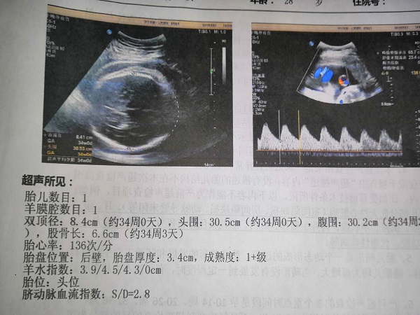 孕期的B超单子图片