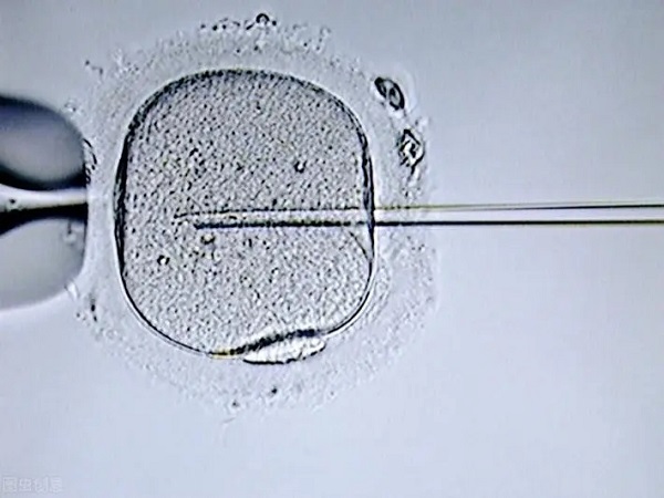 胚胎移植方式和女性的身体有关