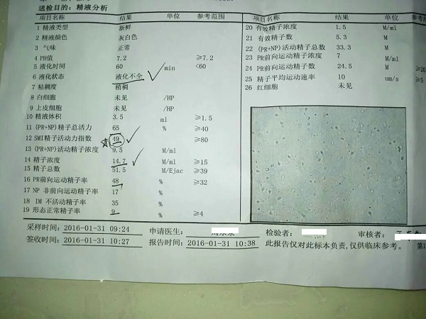 精浆生化出结果的时间是不确定的