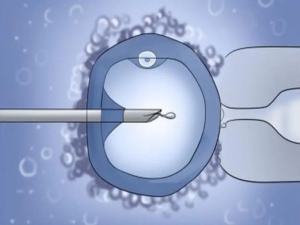 胚胎等级对于试管婴儿成功率有影响