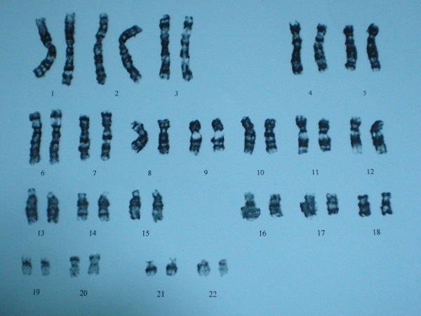 每个人都有23对染色体组成