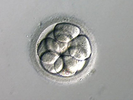 无两个原核的胚胎发生率为5%~15%