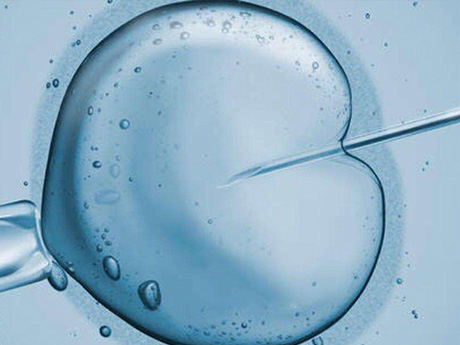 试管婴儿是常见的辅助生殖技术