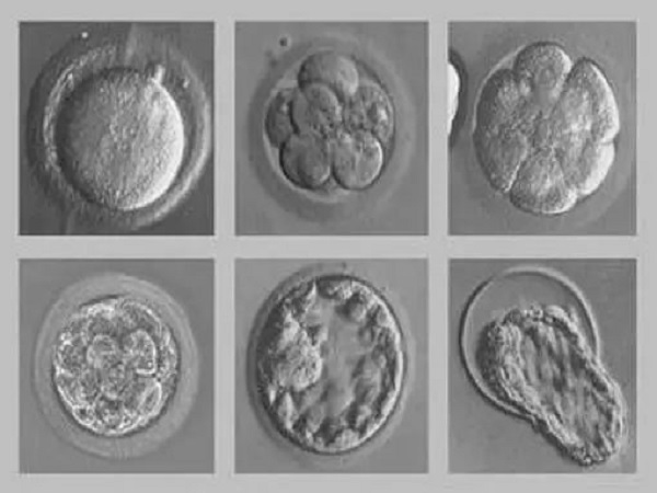 三代试管养囊的成功率取决于胚胎的质量