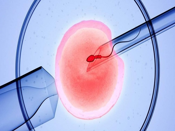 胚胎移植是试管中的关键一环