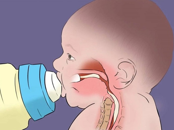不同月龄宝宝适合的奶嘴是不同的
