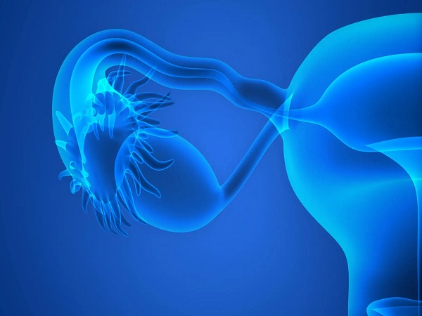 腺肌症是一种常见的妇科疾病