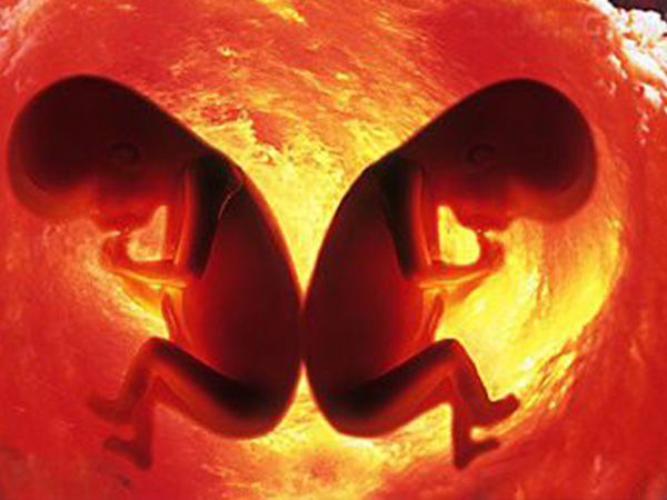 15周减胎对另一个的胎儿的的影响较小