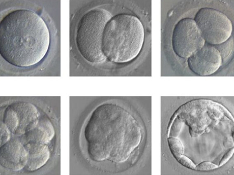 单个囊胚变成双胎有很大的偶然性