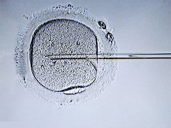 养囊是胚胎培养的一个过程