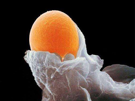 促排药会促进卵泡发育