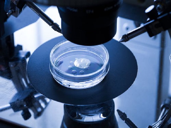 胚胎移植需要专业的医生