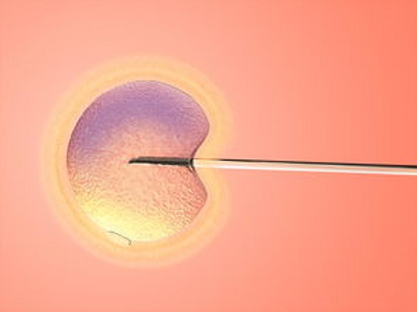 胚胎移植手术是试管的关键