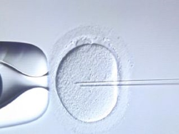 促排卵是试管中的关键一环