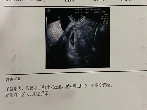 胎心胎芽检查报告单