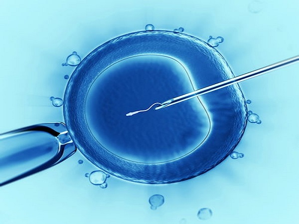 二代试管就是卵泡浆内单精子注射技术