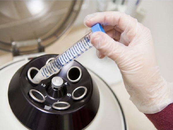 供精试管也是辅助生殖技术的一种