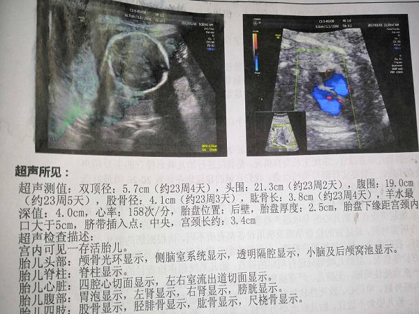 看B超单图像的方法分享