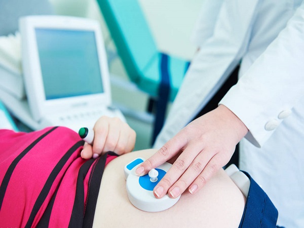 胎心监护是孕期的常见项目