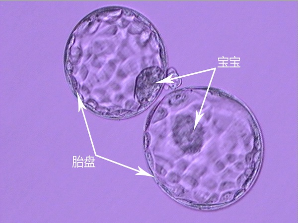 囊胚中包含上百个细胞
