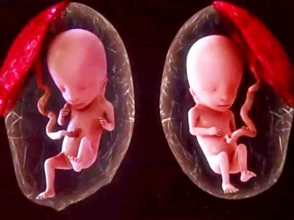 胚胎质量不好几周会胎停不确定