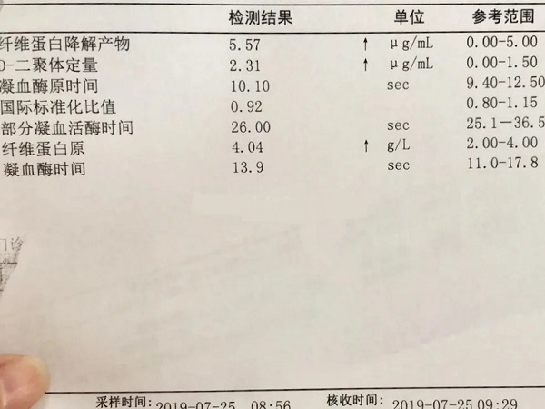 鲜胚移植后d2聚体升高不正常