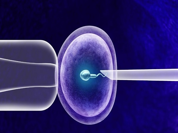 用精子库的精子做试管就是供精试管婴儿