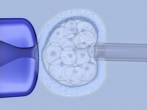 三代试管婴儿也称胚胎植入前遗传诊断技术