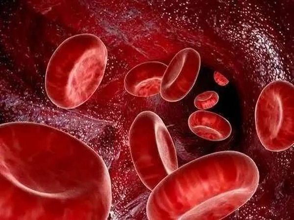 再障性贫血是一种骨髓造血衰竭疾病