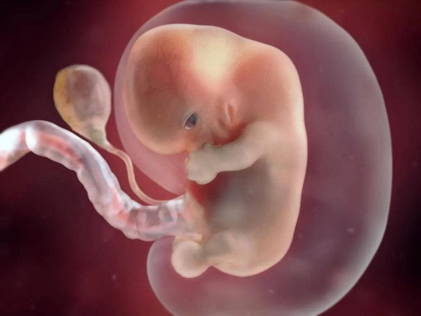 16号染色体重复对胎儿健康有影响