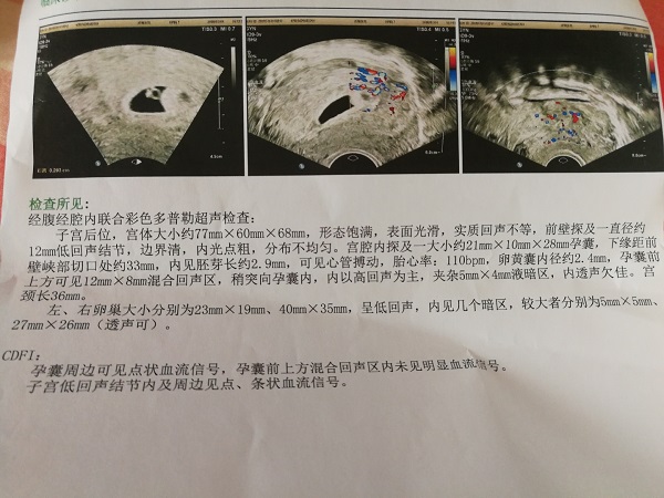 孕9周胎芽25毫米还是可能胎停