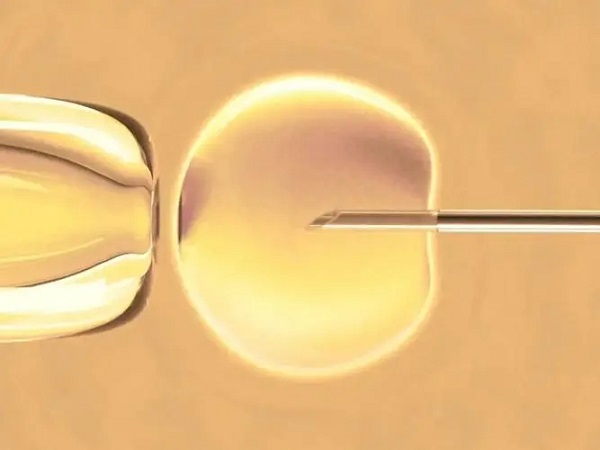 取卵取精是试管治疗中的重要环节