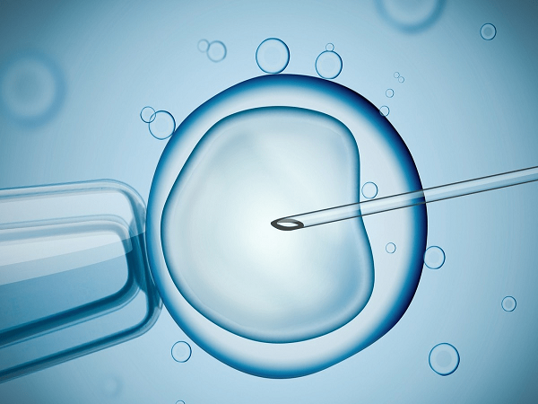 胚胎移植是试管婴儿比较重要的步骤