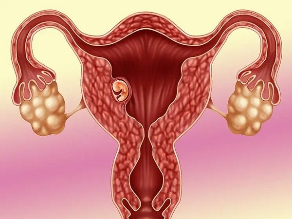 胚胎进入子宫的时间因人而异